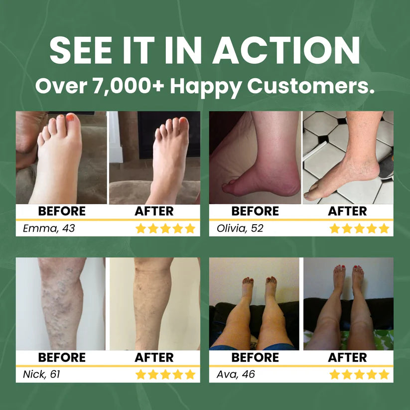 Balmega Swelling Relief