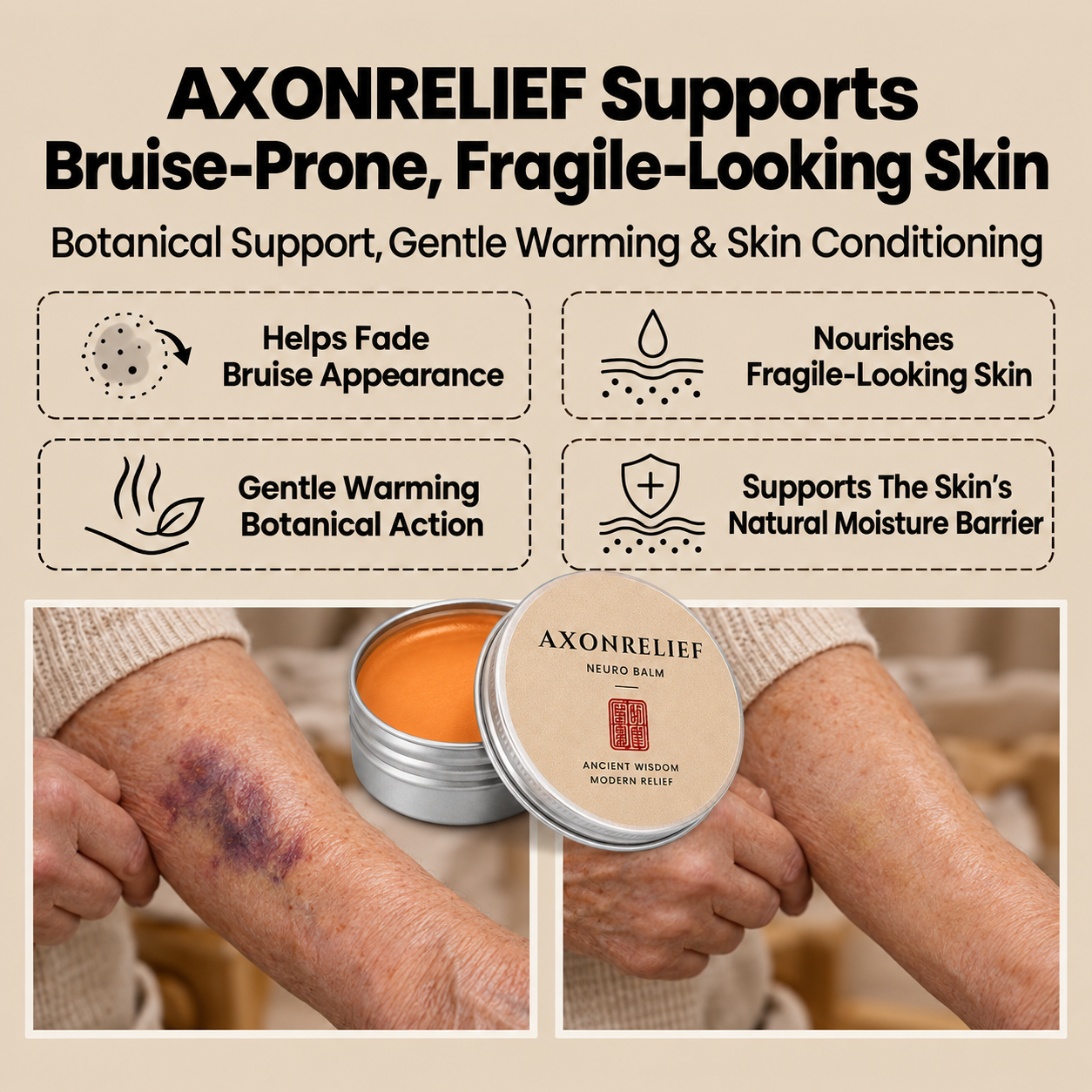 AxonRelief- Finally, A Balm That Fades Bruises On Fragile Skin
